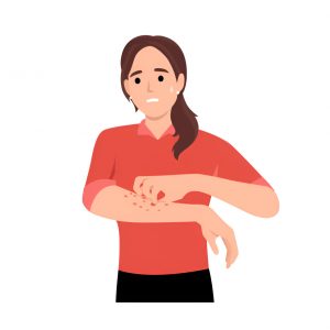 Allergic Reactions and Allergies