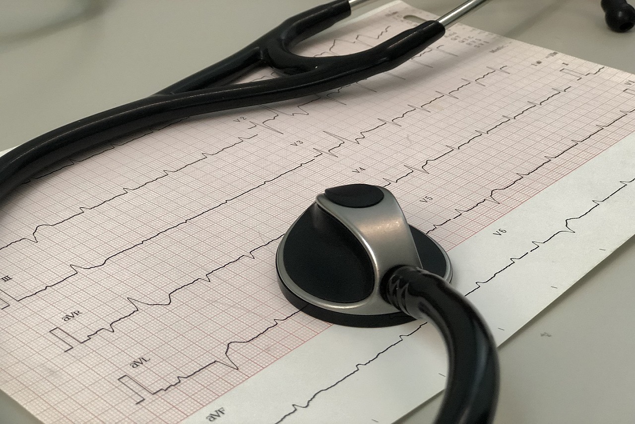 Electrocardiogram (ECG)