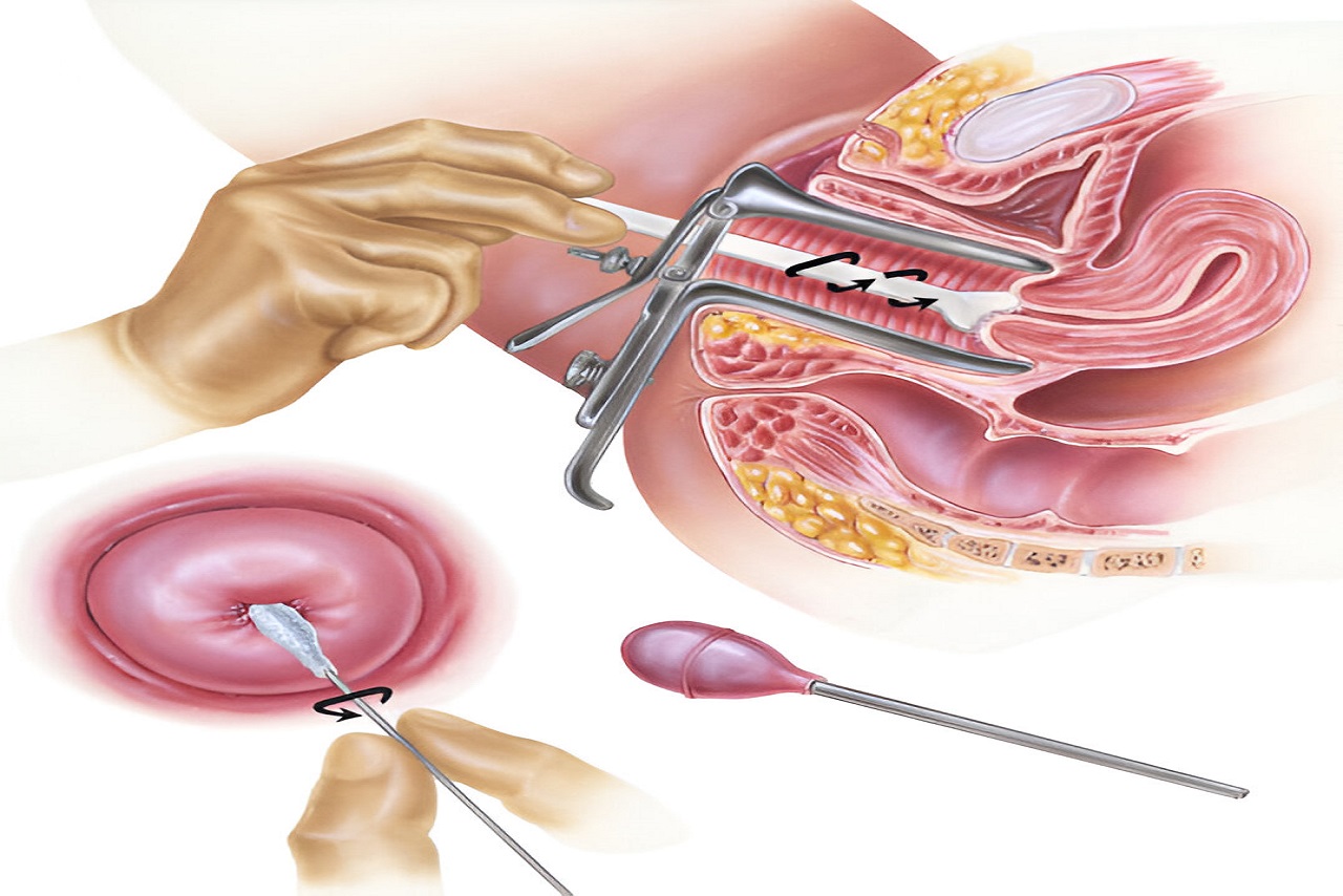 Pap Smears Test