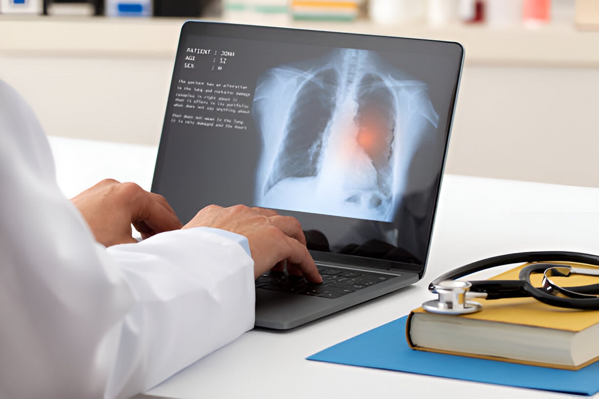 Respiratory Infections