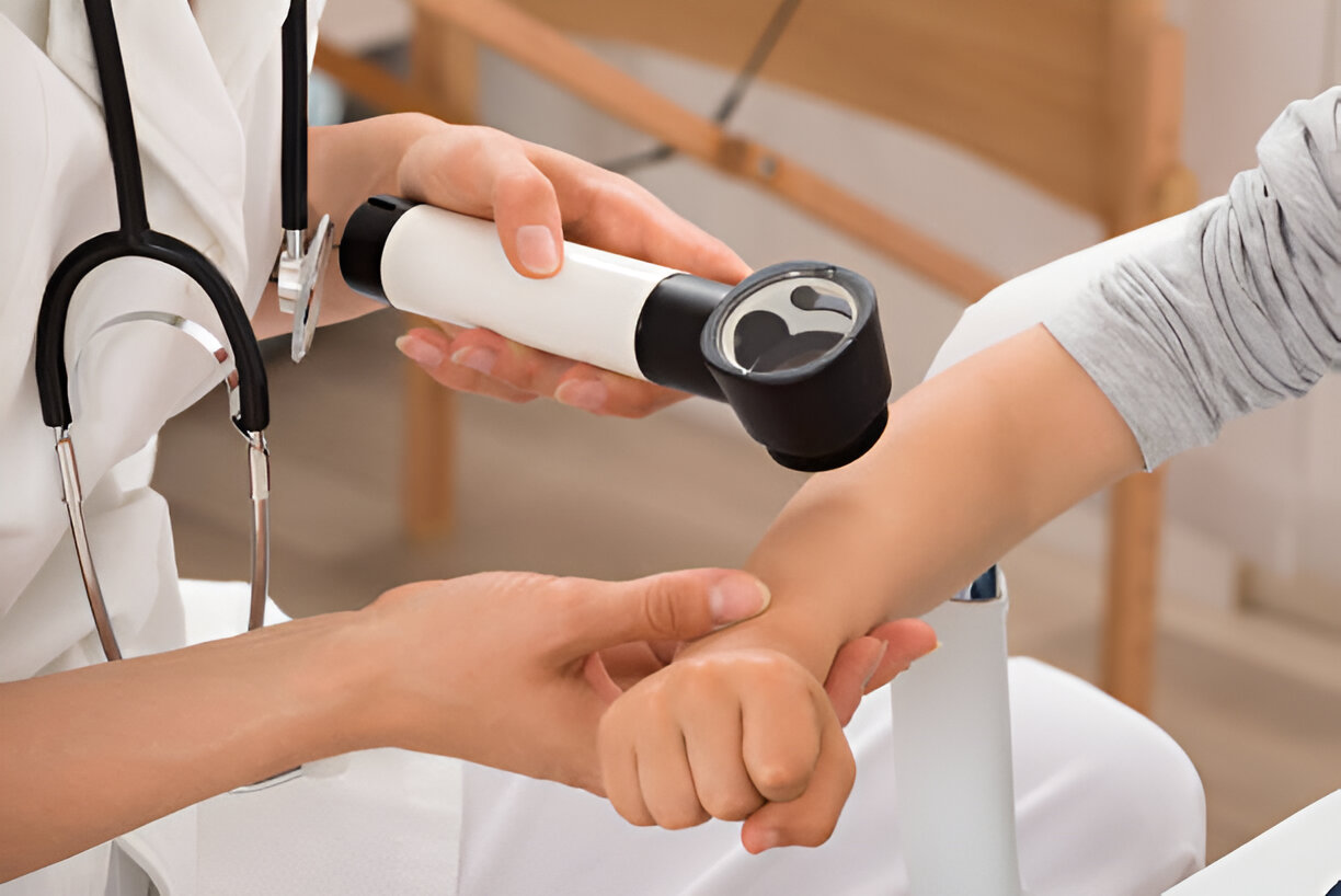 Skin Cancer Screening