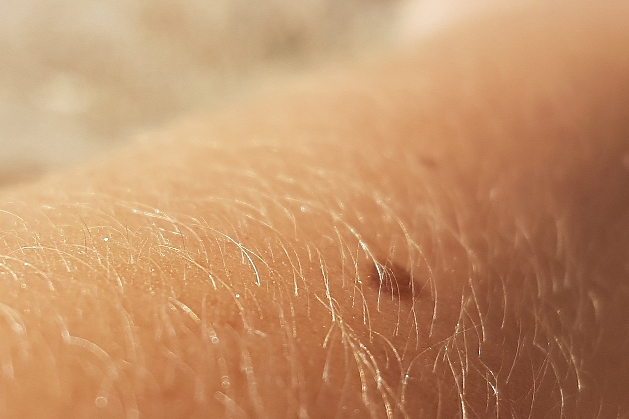 Skin Cancer Screening