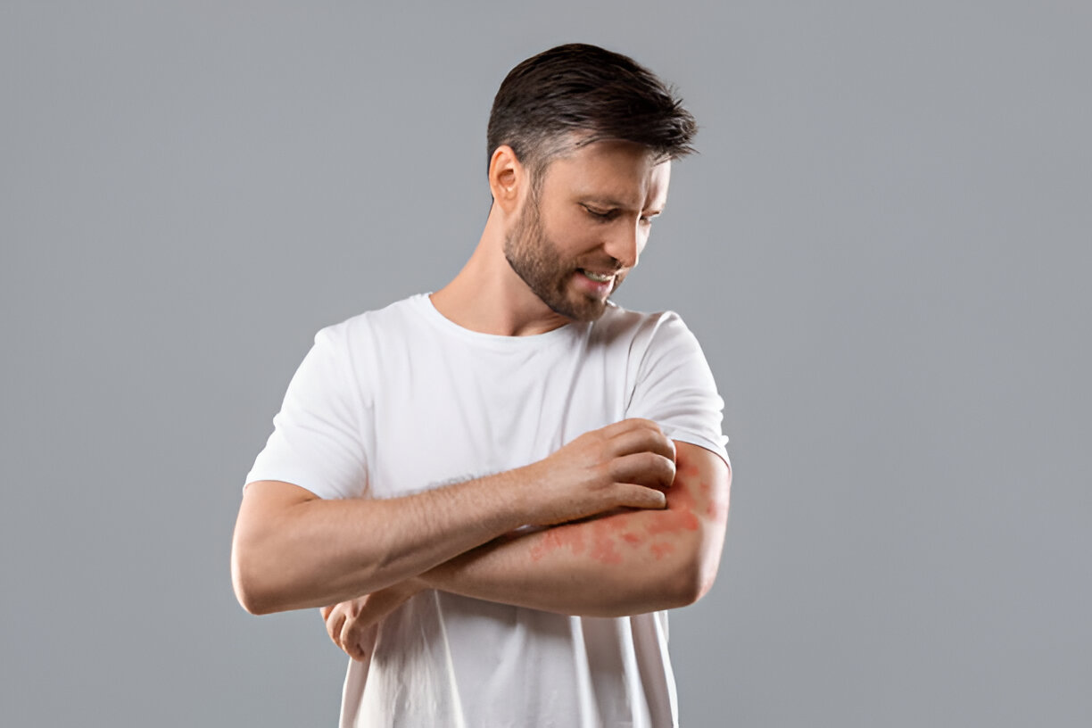 Skin Infections