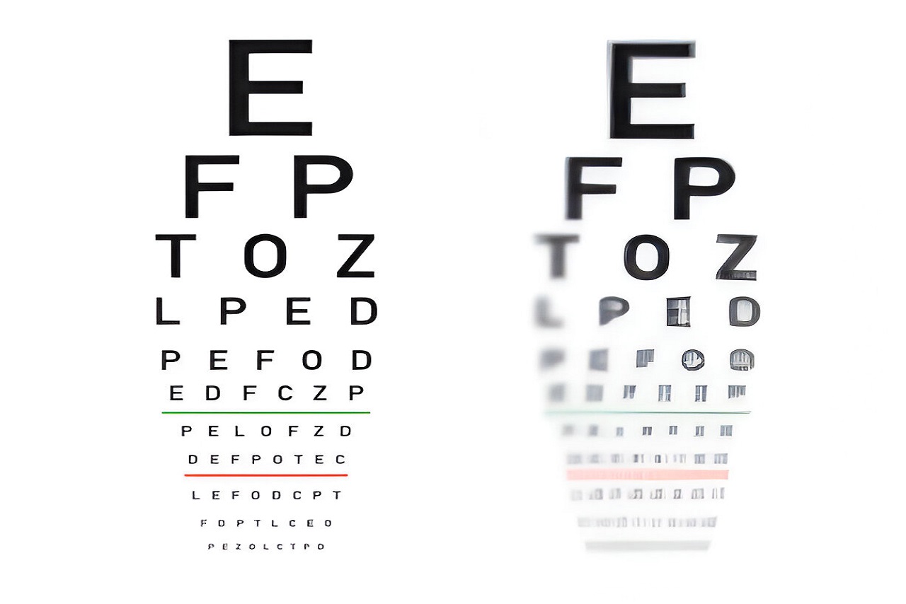 Vision Screening